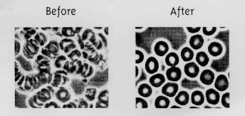 Image of blood before + after